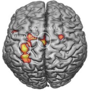 brain